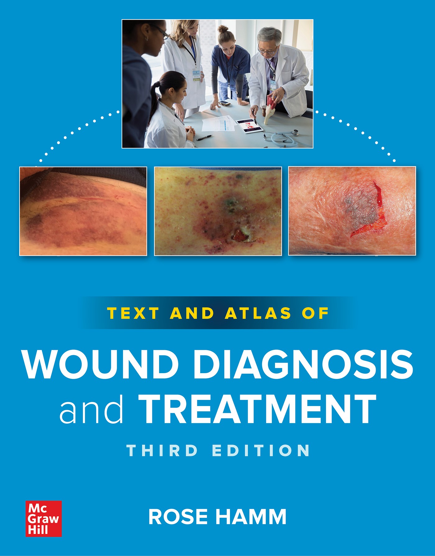 Atlas Wound Diagnosis Cover