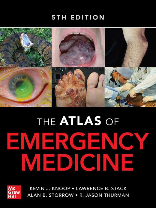 External Ear Injuries | The Atlas of Emergency Medicine, 5e ...