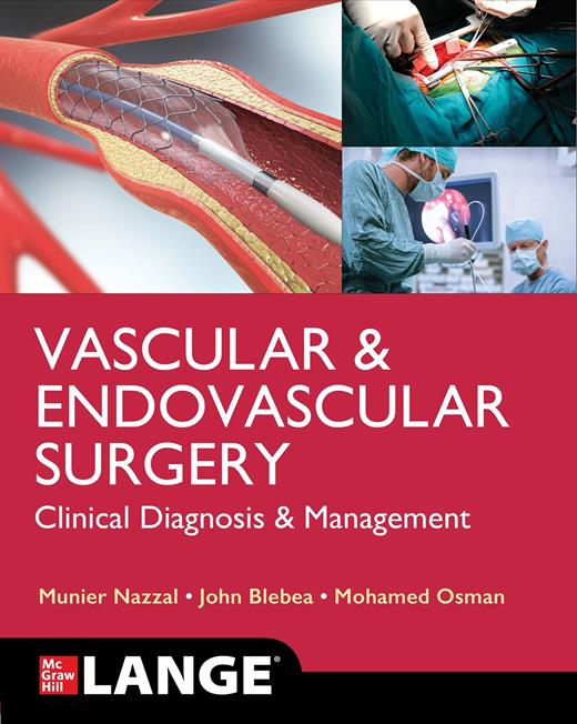 Vascular Surgical Techniques: Open Surgical Exposure of Arteries, Veins ...