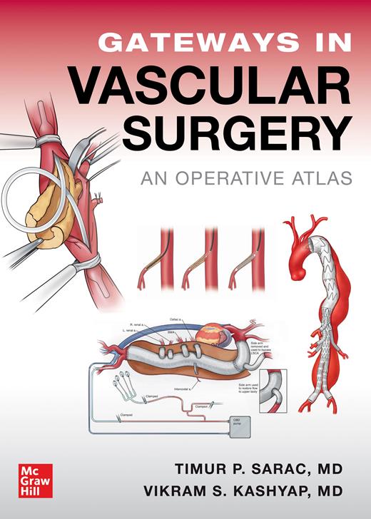 Harvesting and Preparing Vein Conduit | Gateways in Vascular Surgery ...
